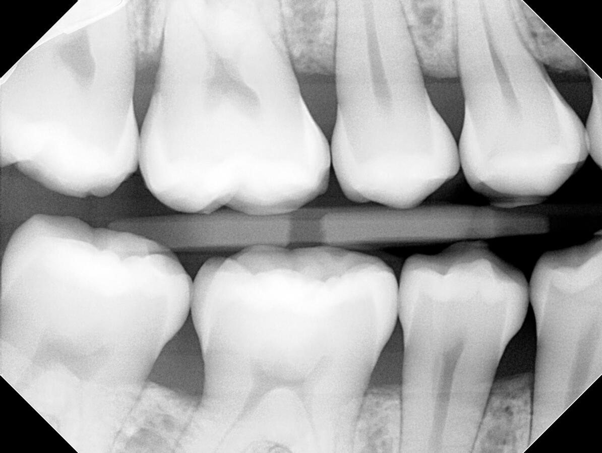 teeth